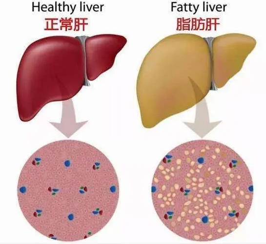 含硒的补肝药物（补硒对肝）-硒宝网
