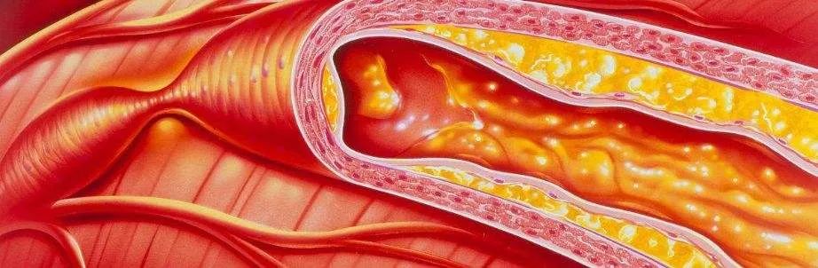 食疗补硒抗癌药(食疗抗癌药补硒效果好吗)-硒宝网