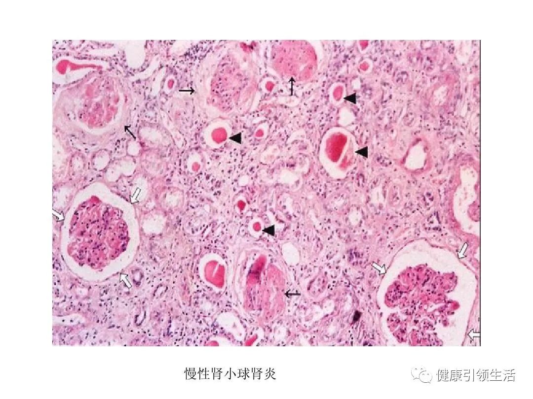 补硒对肾病好吗(吃硒对肾有什么好处)-硒宝网