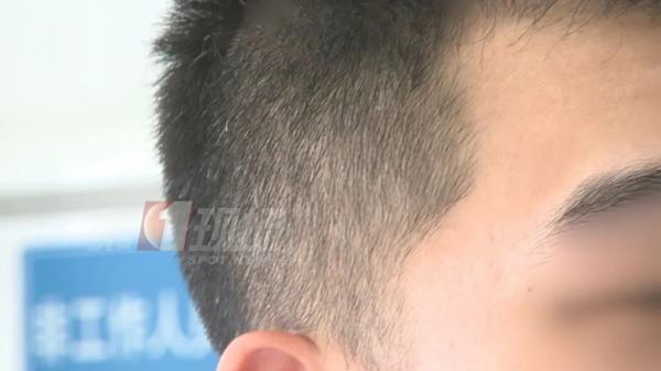 补硒后白发变黄（补硒能让白头发变黑吗）-硒宝网