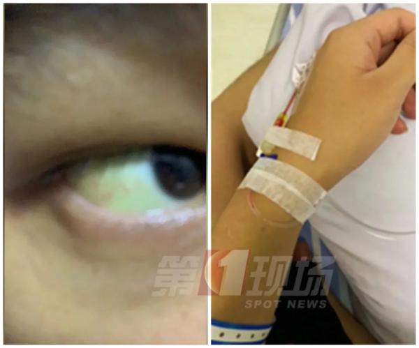 补硒后白发变黄（补硒能让白头发变黑吗）-硒宝网