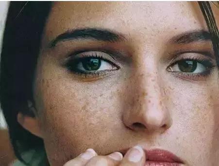 补硒多久能祛斑（硒对斑块的好处）-硒宝网