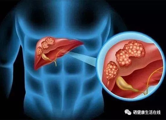 补硒会不会伤肝（硒对肝病有什么好处）-硒宝网