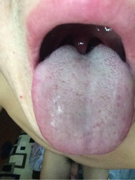 硒吃什么药能补(吃补硒药有什么副作用)-硒宝网