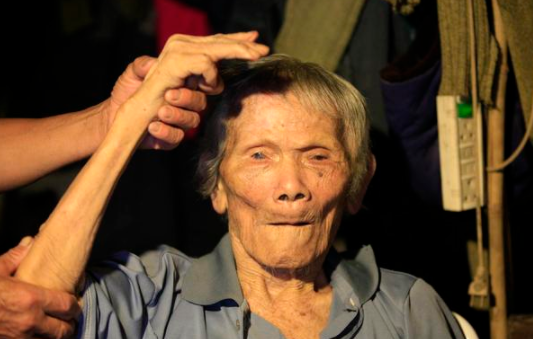 脑梗塞能补硒吗(脑梗补硒管用吗)-硒宝网