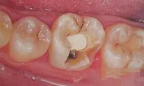 钙锌硒能同补吗(钙锌硒维生素)-硒宝网