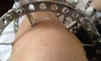 钙锌硒能同补吗(钙锌硒维生素)-硒宝网