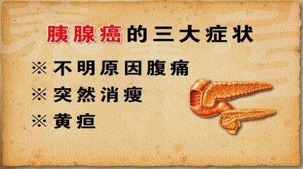 胰腺癌能补硒么（胰腺癌可以补硒吗）-硒宝网