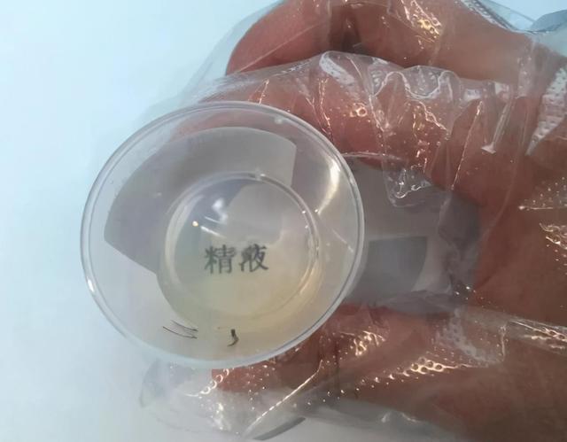 鱼鳞病能补硒吗(鱼鳞病补充维生素)-硒宝网