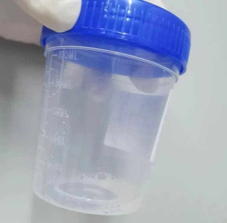 鱼鳞病能补硒吗(鱼鳞病补充维生素)-硒宝网