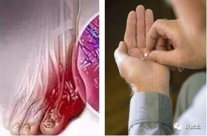 补硒的药伤肝吗（硒片对肝有哪些作用）-硒宝网