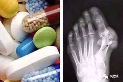 补硒的药伤肝吗（硒片对肝有哪些作用）-硒宝网