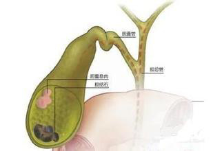 直肠癌能补硒吗（能补直肠癌硒的食物）-硒宝网