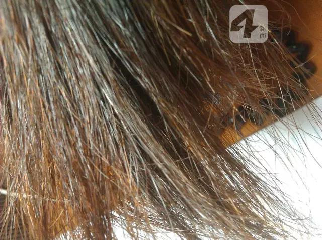 补硒和维生素b（补维生素硒用什么药）-硒宝网