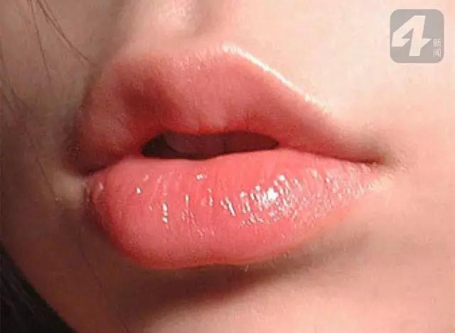 补硒和维生素b（补维生素硒用什么药）-硒宝网