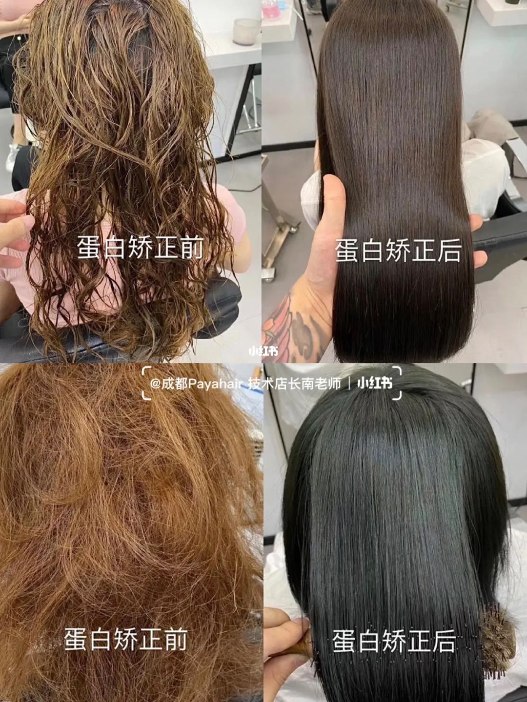 补硒后头皮屑多（补头皮屑硒后用什么药）-硒宝网