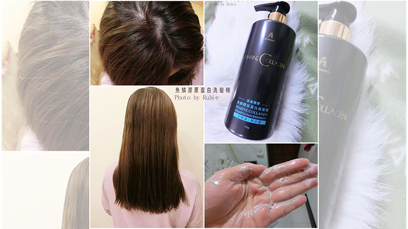 补硒后头皮屑多（补头皮屑硒后用什么药）-硒宝网