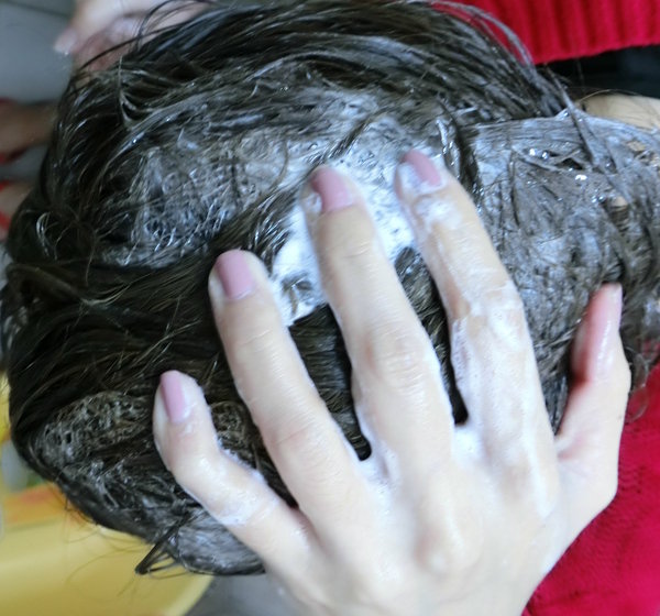 补硒后头皮屑多（补头皮屑硒后用什么药）-硒宝网