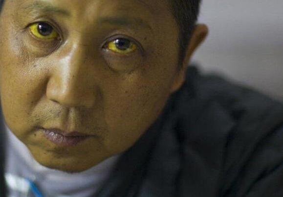 抑郁症能补硒吗(硒对抑郁症)-硒宝网