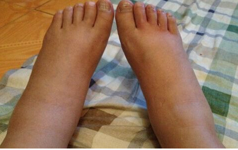 抑郁症能补硒吗(硒对抑郁症)-硒宝网