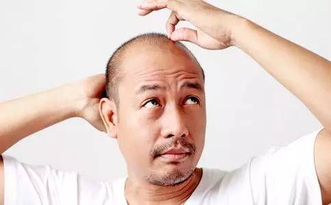 补硒会掉头发么(补硒对脱发有效果吗)-硒宝网