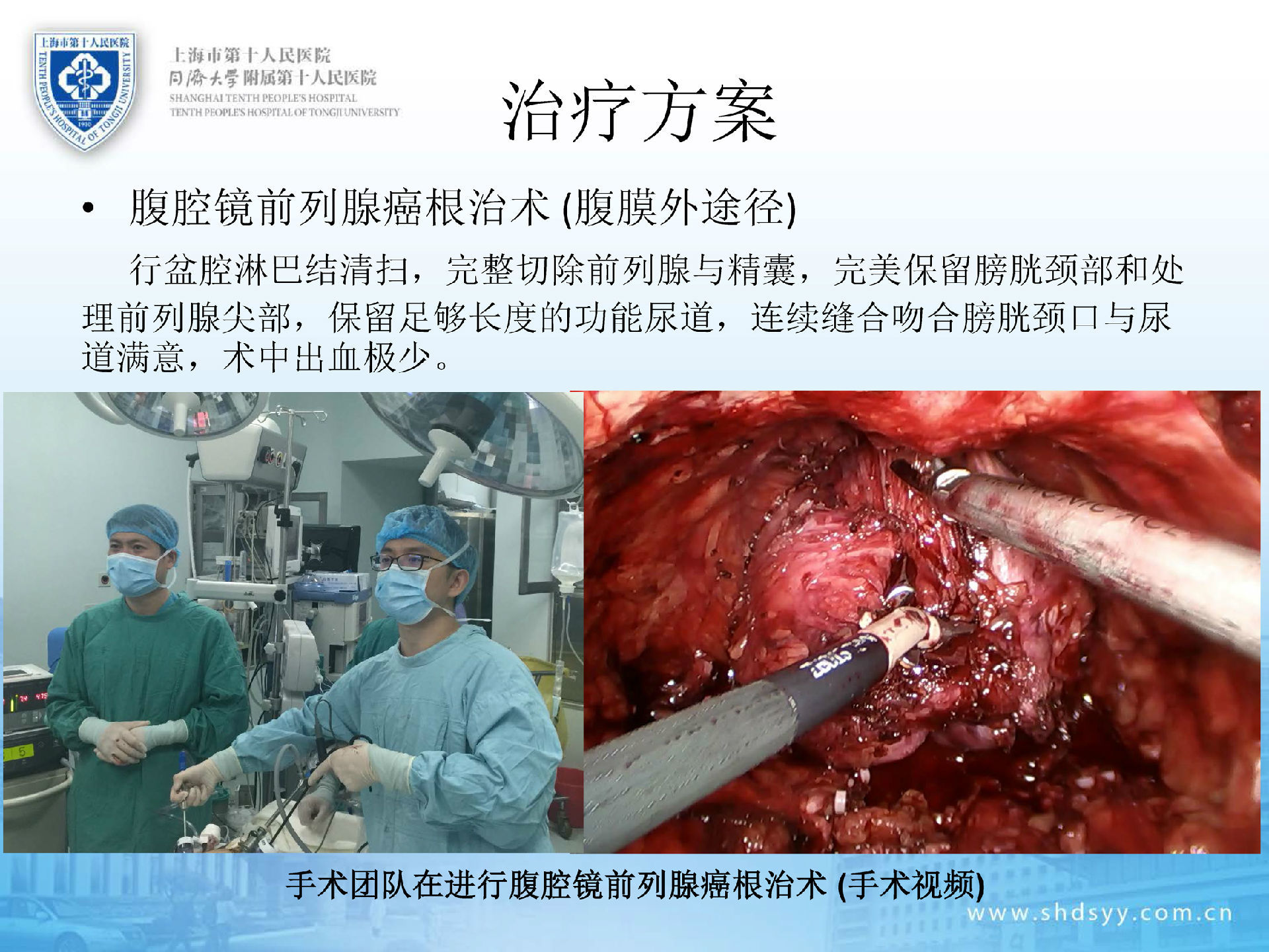 补硒与前列腺癌(前列腺补硒)-硒宝网