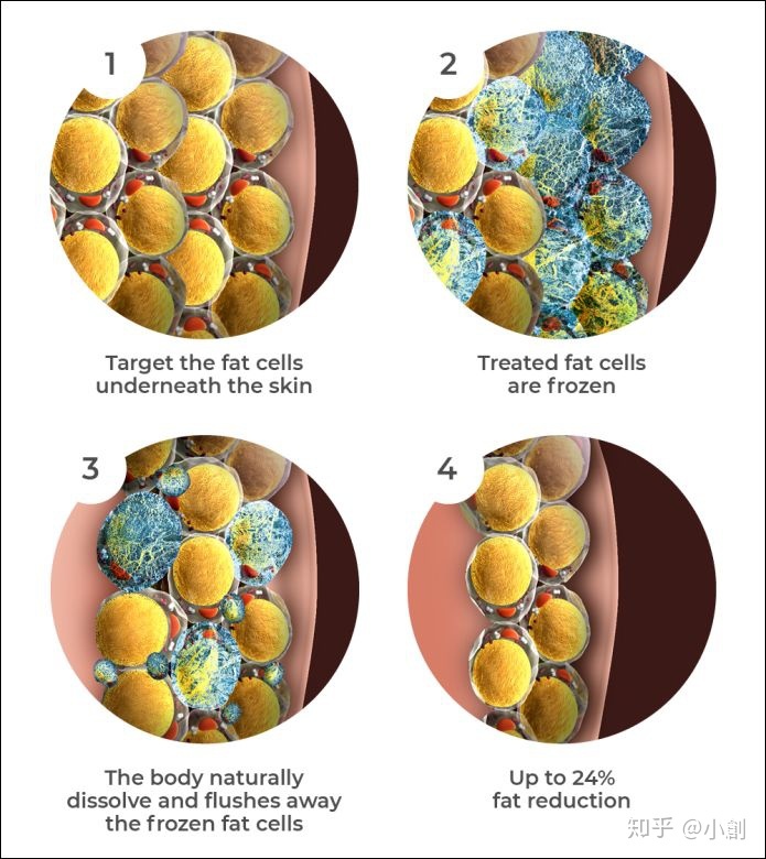 羊怎么样能补硒(羊补硒用什么药了)-硒宝网