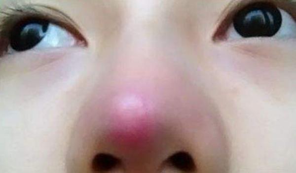 肝不好用补硒吗(补硒肝脏)-硒宝网