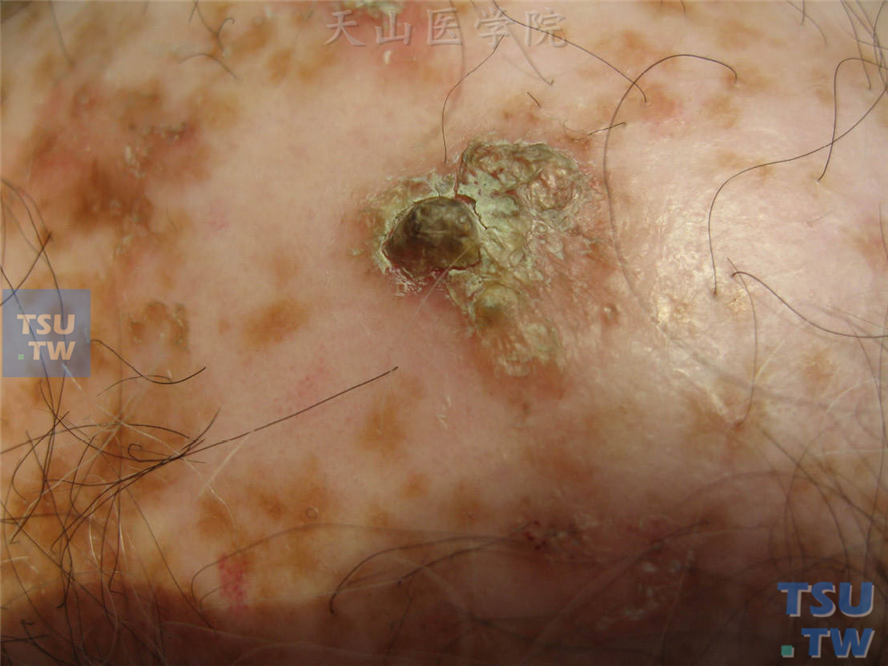 老人皮肤痒补硒(老年人补硒)-硒宝网