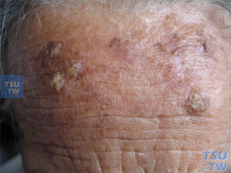 老人皮肤痒补硒(老年人补硒)-硒宝网