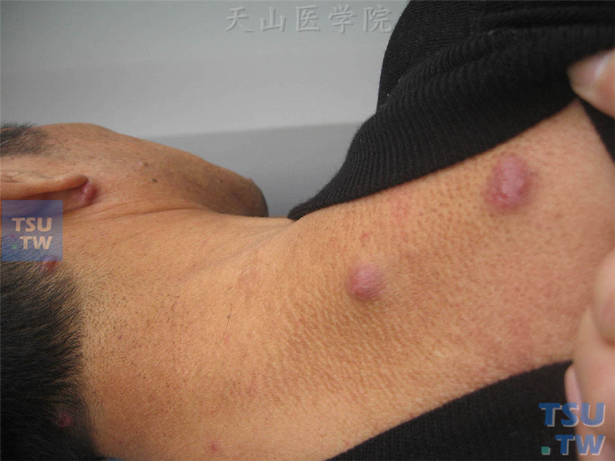 老人皮肤痒补硒(老年人补硒)-硒宝网