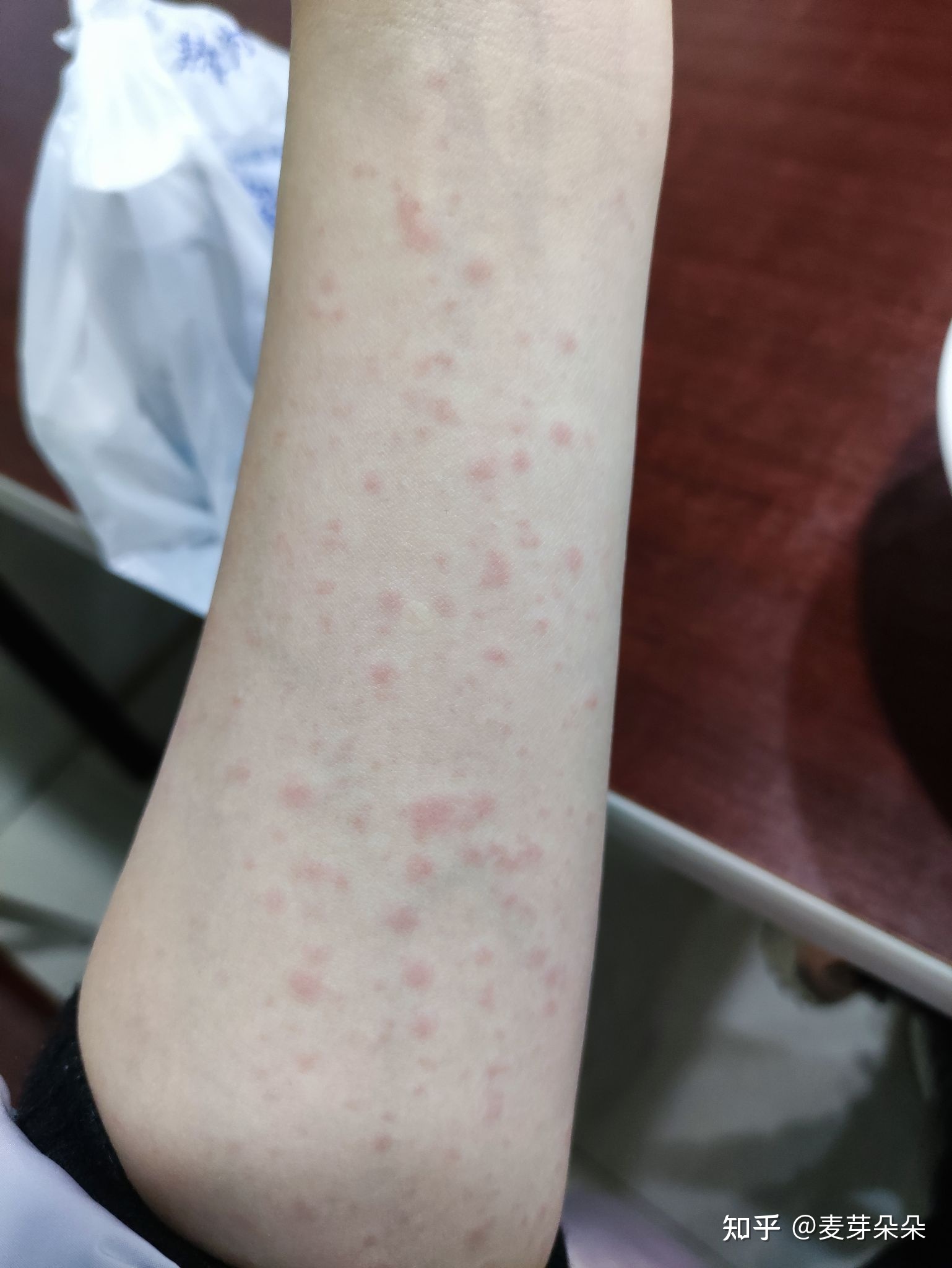 富硒的食物水果(水果食物富硒含量排名)-硒宝网