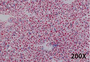 硒产品抗癌用量(硒抗癌症)-硒宝网