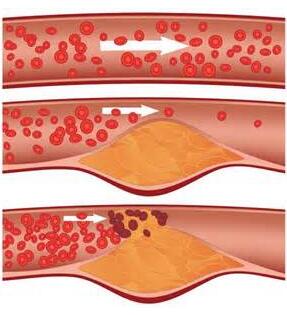 麦芽硒维康好吗（麦芽硒维e和硒维康哪种好）-硒宝网