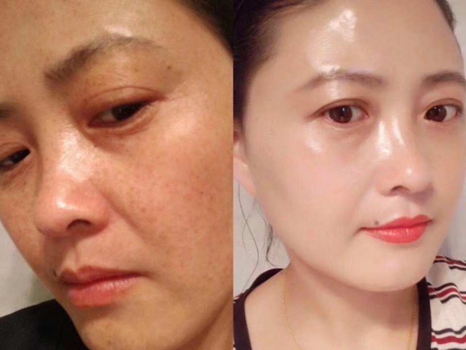 硒维康皮肤发黄（硒片对皮肤的作用）-硒宝网