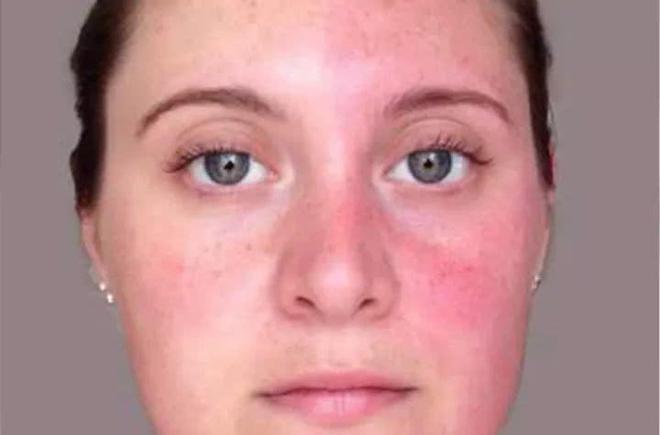 硒维康皮肤发黄（硒片对皮肤的作用）-硒宝网