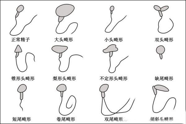 锌硒宝精子畸形(锌硒宝生精吗)-硒宝网