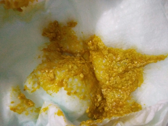 锌硒宝哪种好用(锌硒宝有几种)-硒宝网