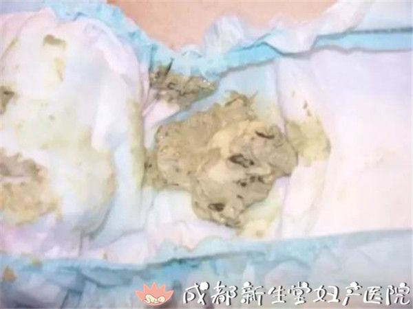 锌硒宝哪种好用(锌硒宝有几种)-硒宝网