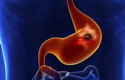 肠胃病补什么硒好(肠胃不好吃硒管用吗)-硒宝网