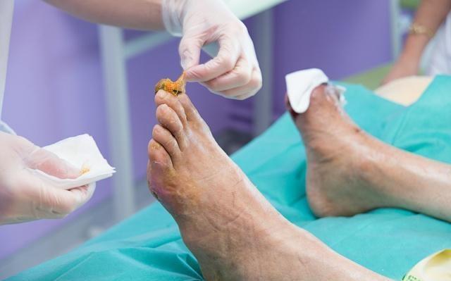 补着硒为什么血糖还升高(血糖高吃硒片好吗)-硒宝网