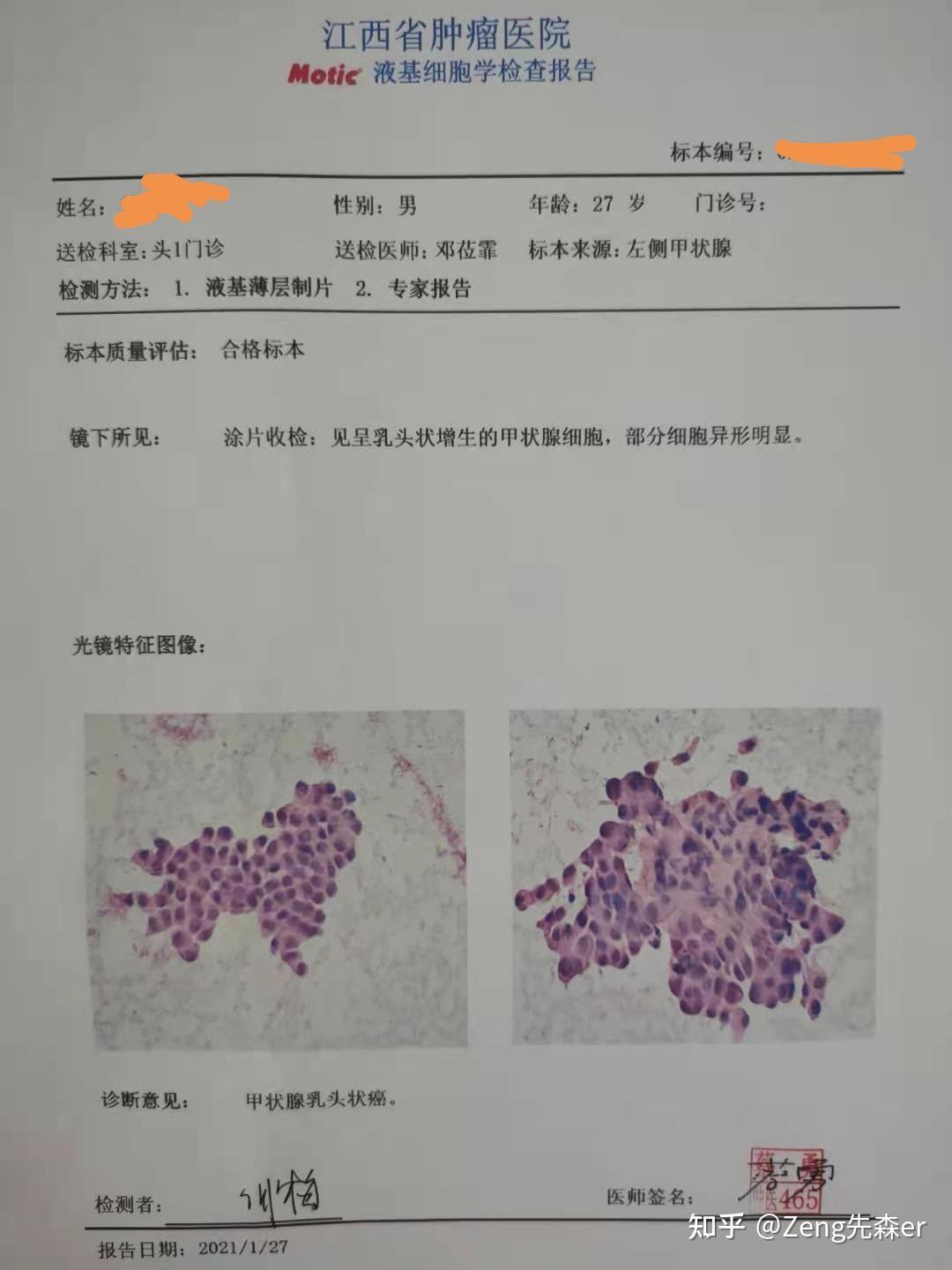 乔本甲状腺补硒（乔本甲状腺炎补硒）-硒宝网
