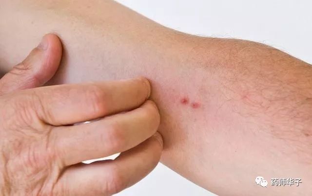 皮肤病人补硒后皮肤瘙痒（为什么补硒会皮肤痒）-硒宝网