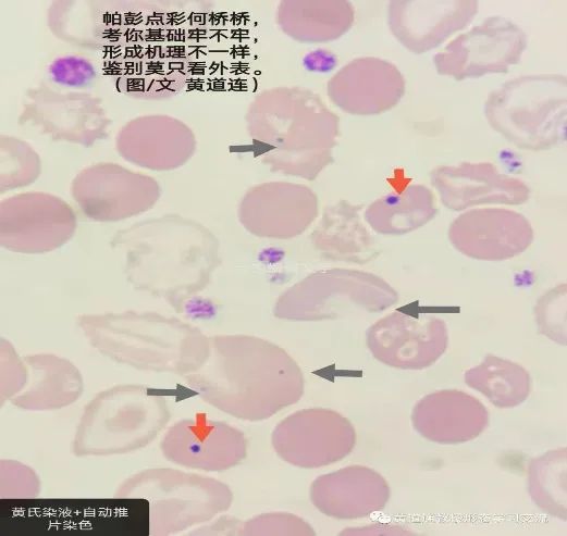 血小板低可以补硒吗（补血小板低硒可以吗）-硒宝网
