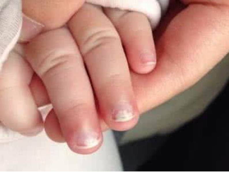 锌硒宝儿童补锌(儿童锌硒宝)-硒宝网