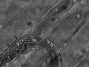 锌硒宝吃完口苦(宝宝吃锌硒宝片嘴巴周围红)-硒宝网