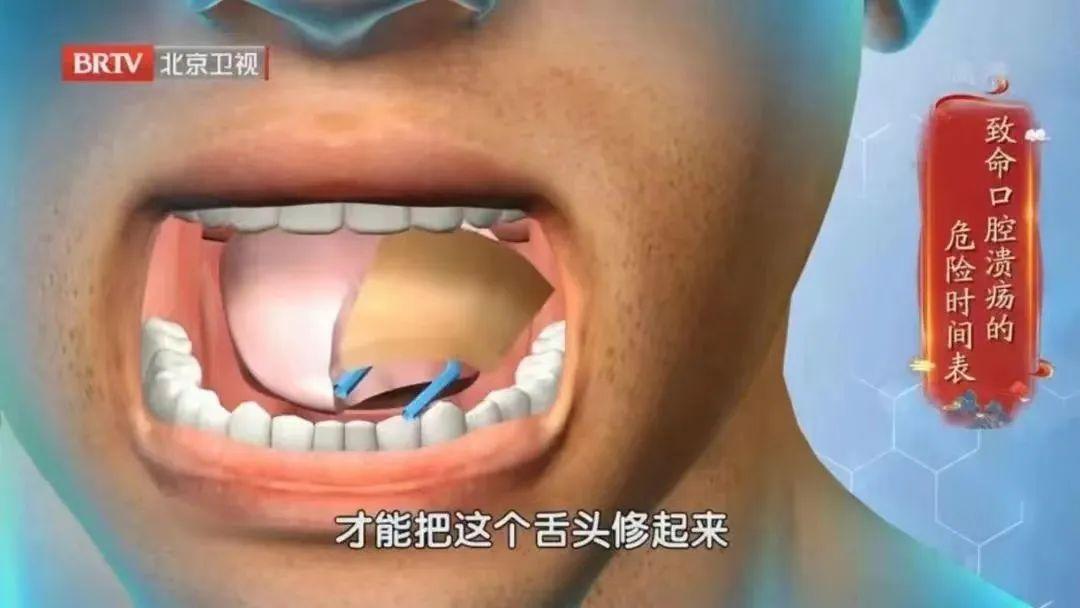 吃锌硒宝片上火（锌会不会上火）-硒宝网