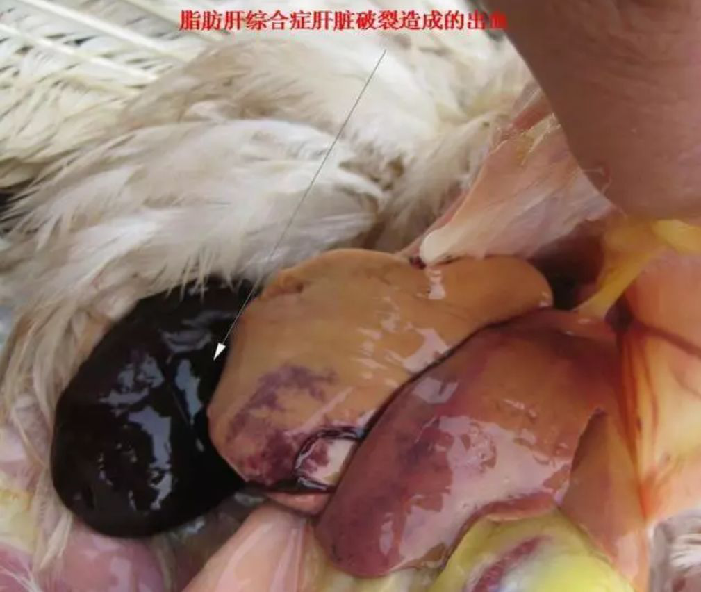 锌硒宝对肝好吗（锌硒宝好不好）-硒宝网