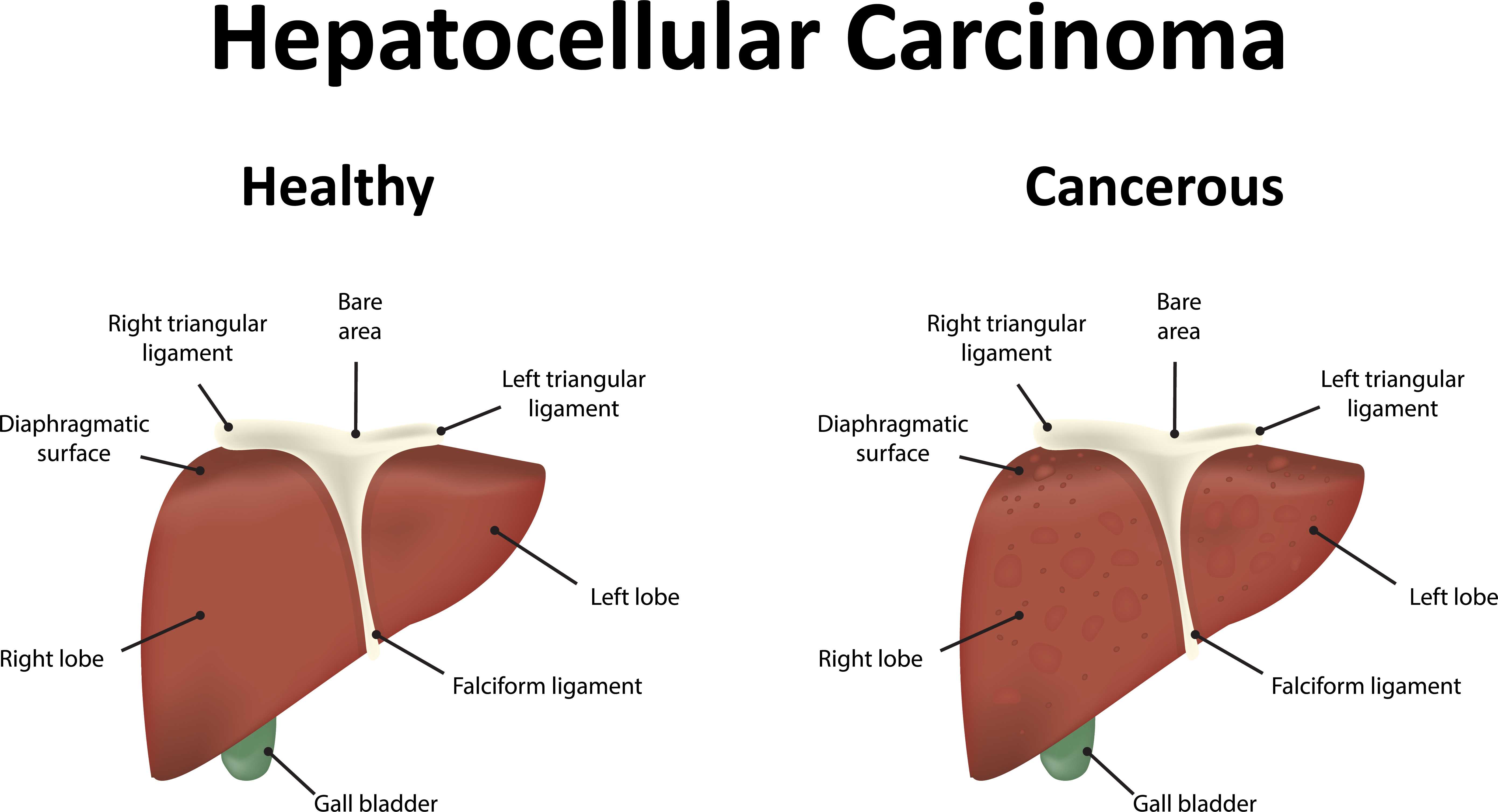 锌硒宝对肝好吗（锌硒宝好不好）-硒宝网