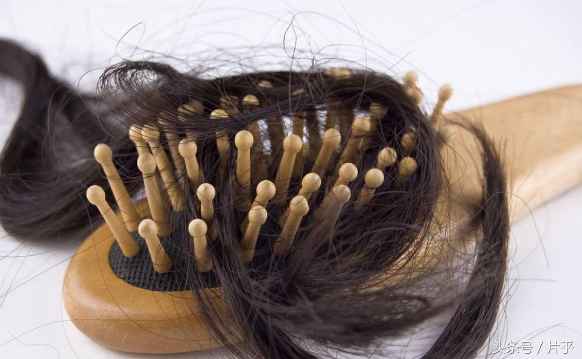 锌硒宝治脱发吗（锌硒宝片对脱发有效果吗）-硒宝网